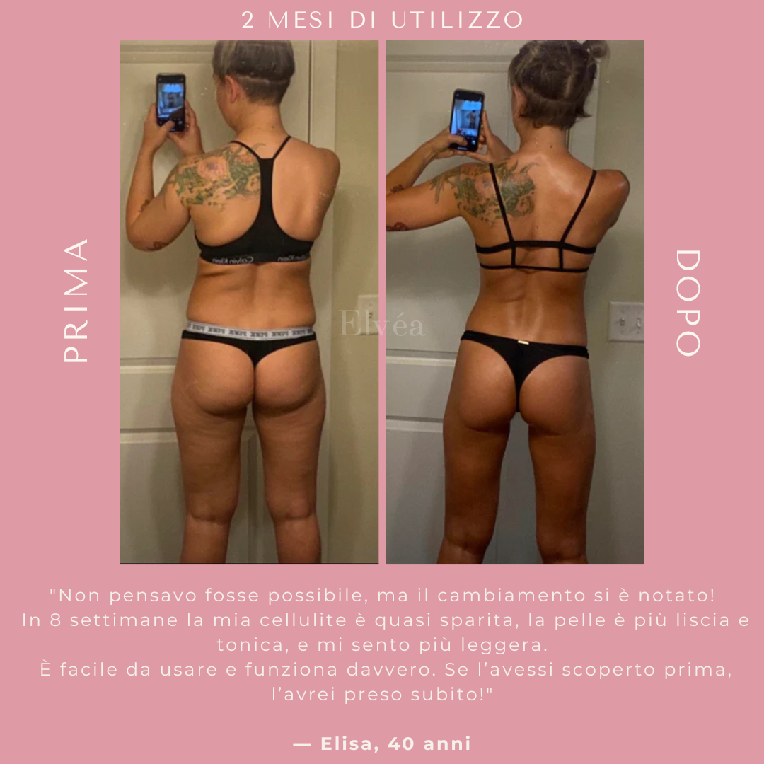 Massaggiatore a coppettazione Elvèa