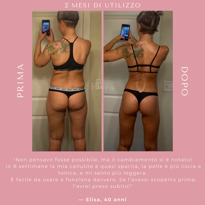 Massaggiatore a coppettazione Elvèa