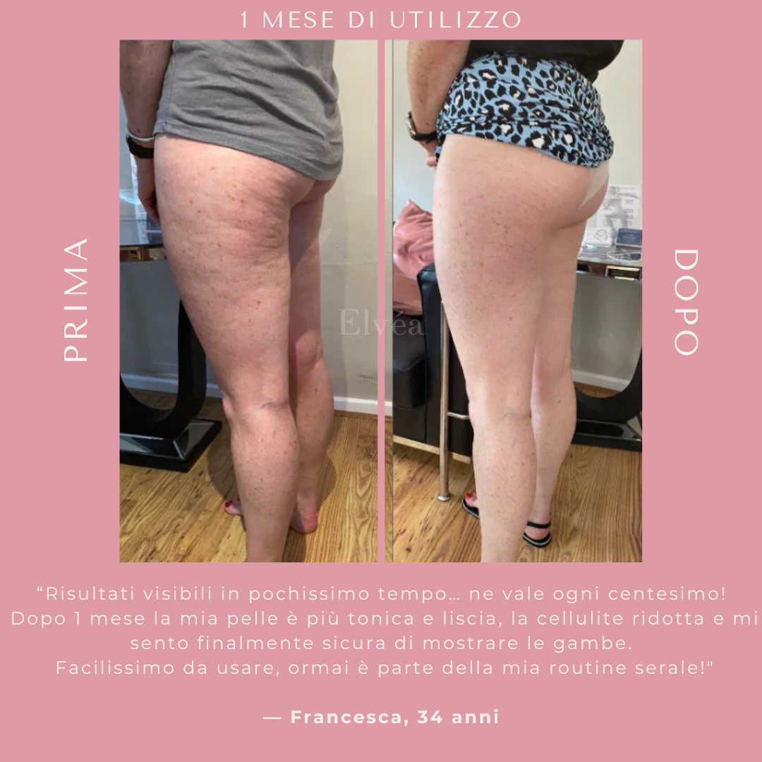 Massaggiatore a coppettazione Elvèa