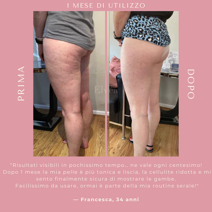 Massaggiatore a coppettazione Elvèa