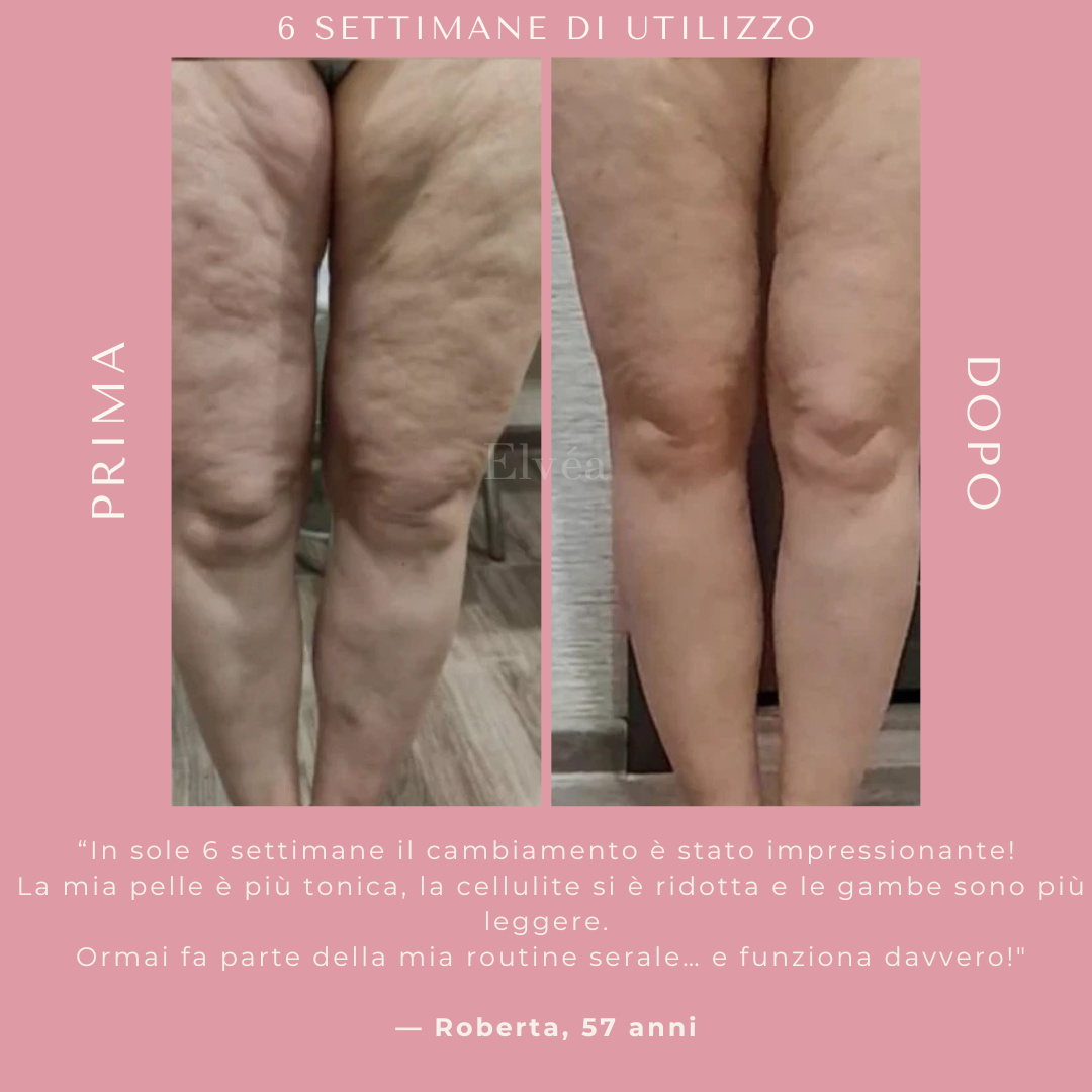 Massaggiatore a coppettazione Elvèa