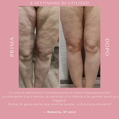 Massaggiatore a coppettazione Elvèa