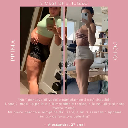 Massaggiatore a coppettazione Elvèa